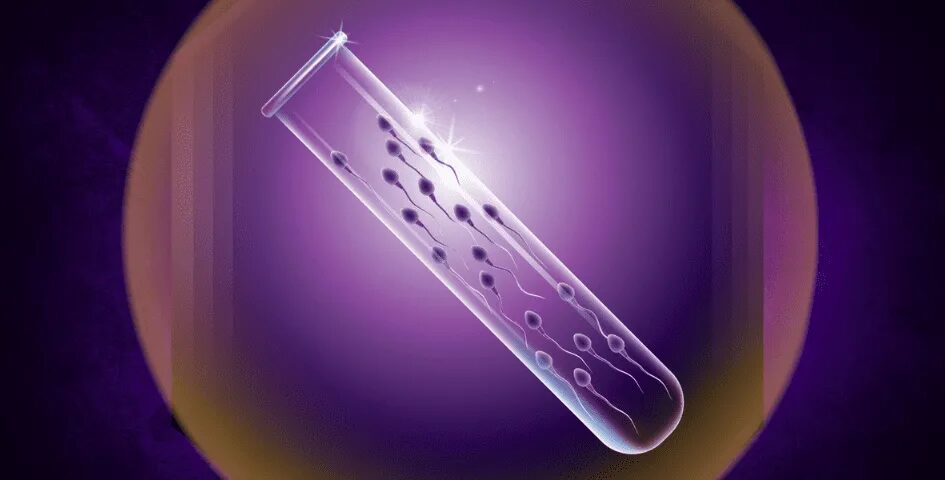 Semen Testing